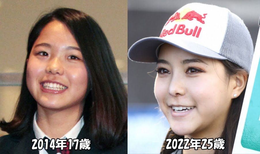 高梨沙羅14年と22年比較